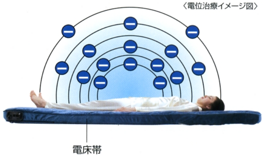 電位治療イメージ図